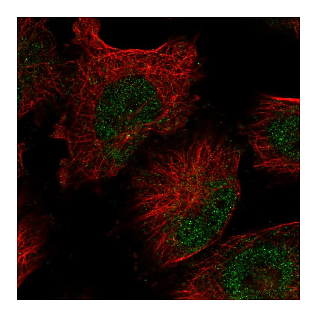Atlas Antibodies Anti-FAM208B Antibody