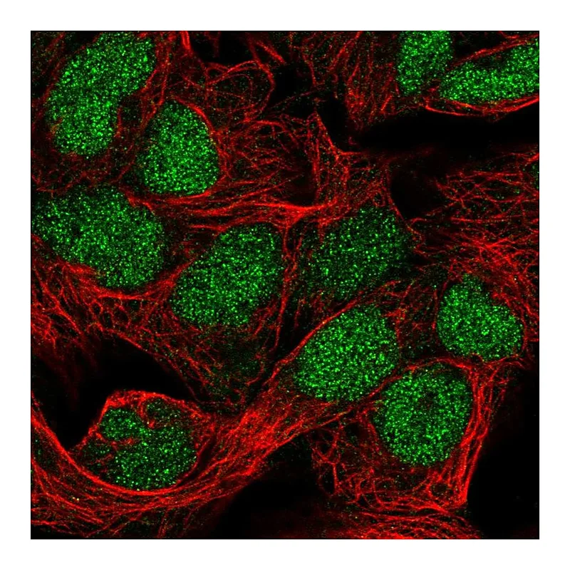 Atlas Antibodies Anti-FAM208B Antibody