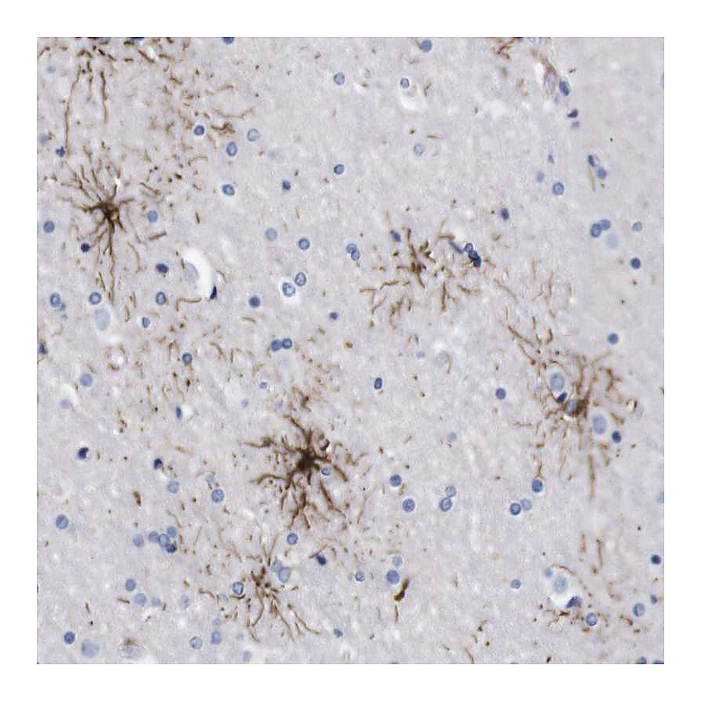 Atlas Antibodies Anti-FAM210A Antibody