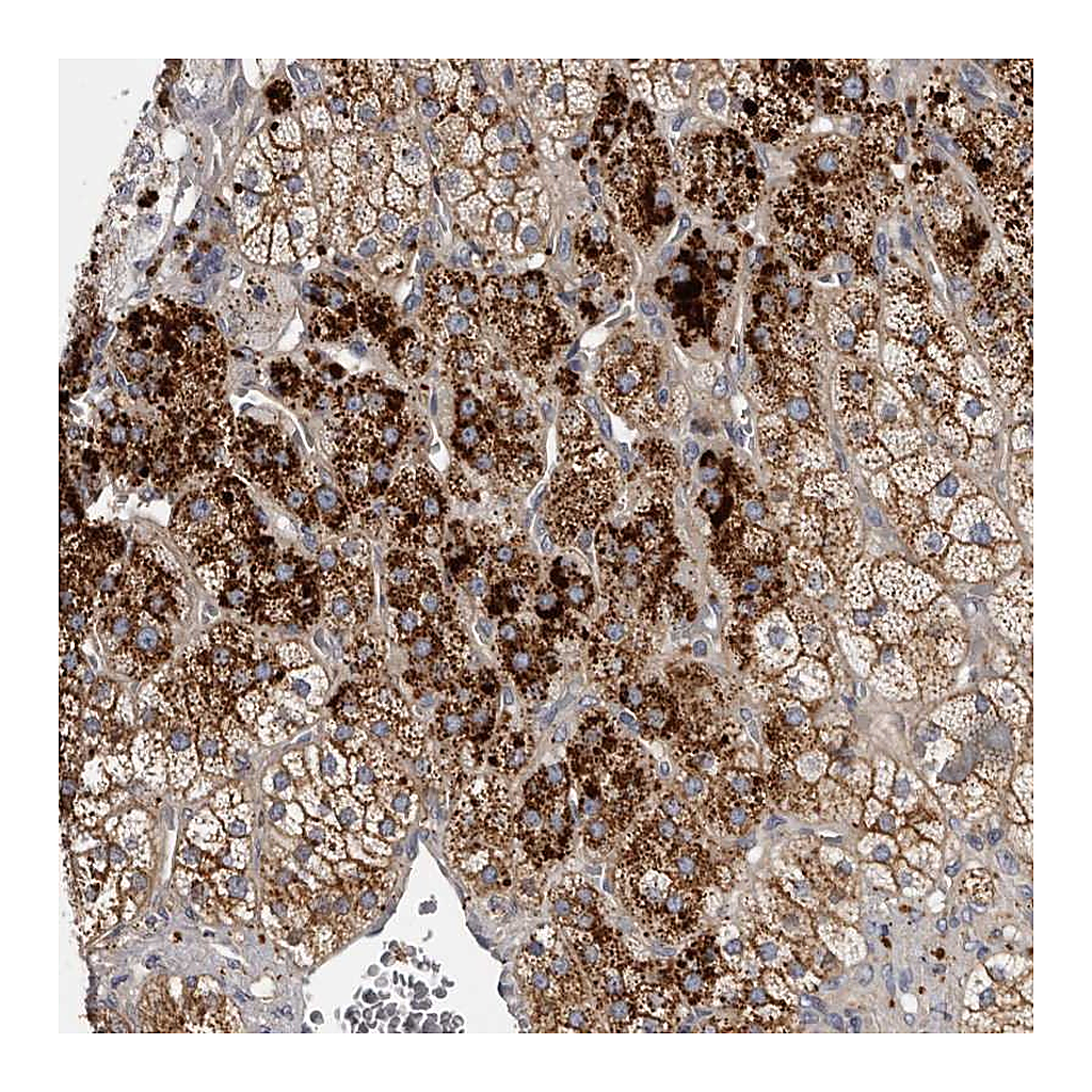 Atlas Antibodies Anti-FAM212B Antibody