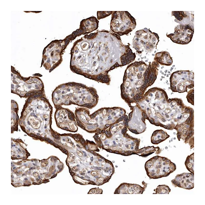 Atlas Antibodies Anti-FAM212B Antibody