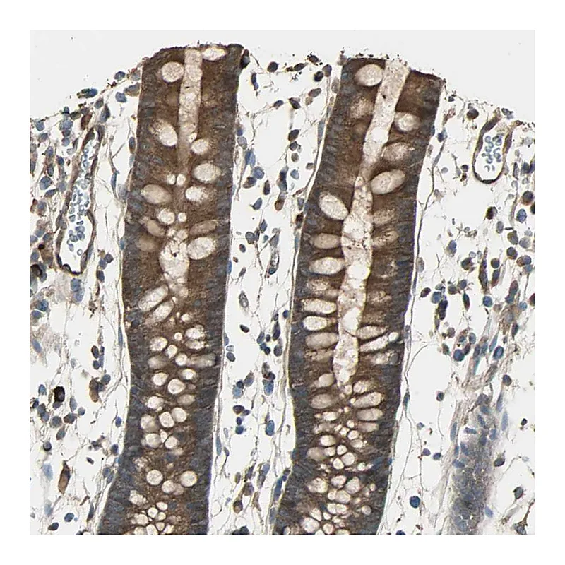 Atlas Antibodies Anti-FAM213B Antibody