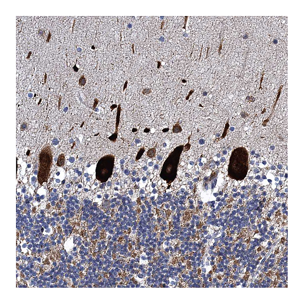 Atlas Antibodies Anti-FAM214A Antibody