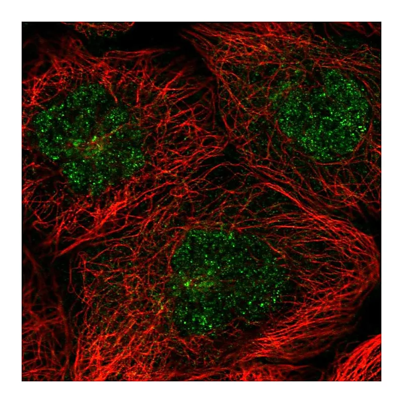 Atlas Antibodies Anti-FAM217B Antibody