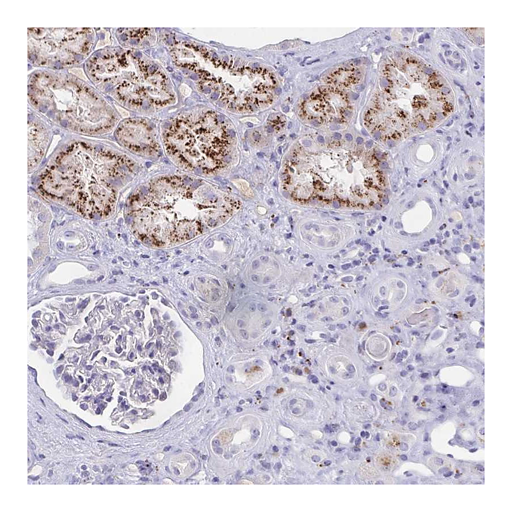 Atlas Antibodies Anti-FAM219B Antibody