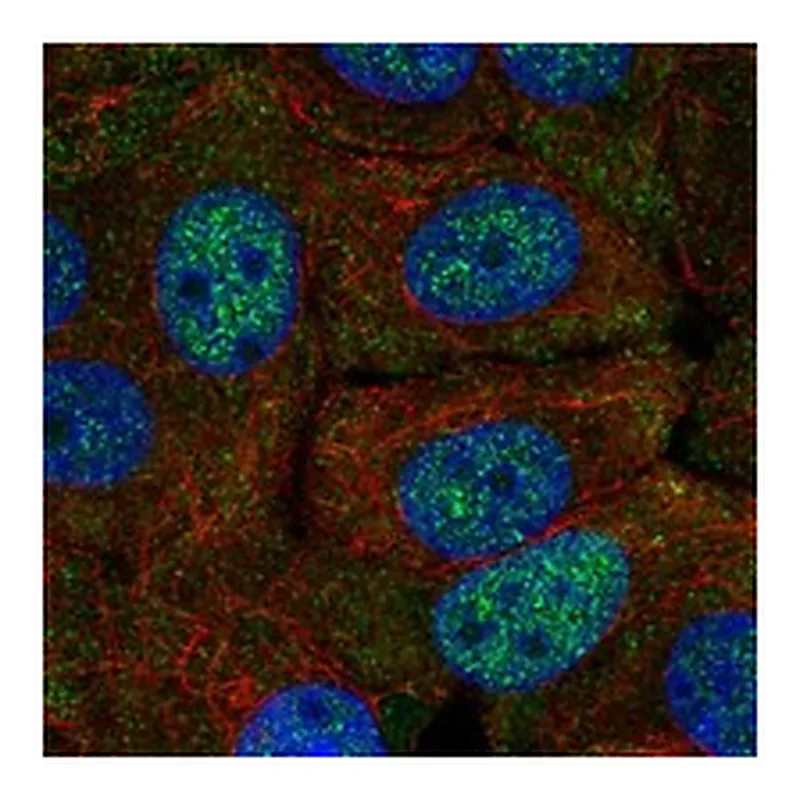 Atlas Antibodies Anti-FAM222A Antibody