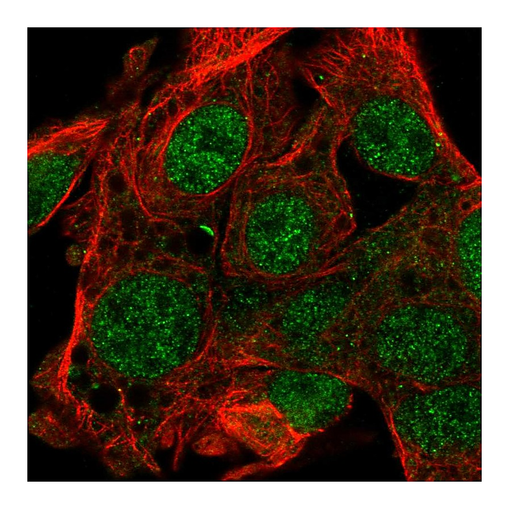 Atlas Antibodies Anti-FAM222B Antibody