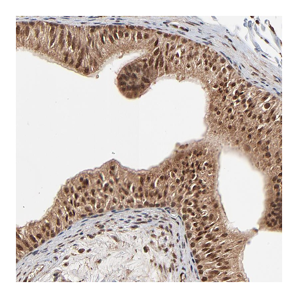 Atlas Antibodies Anti-FAM227A Antibody