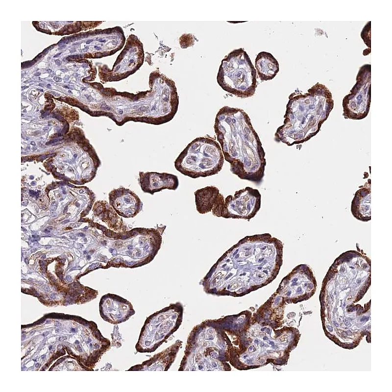 Atlas Antibodies Anti-FAM227B Antibody