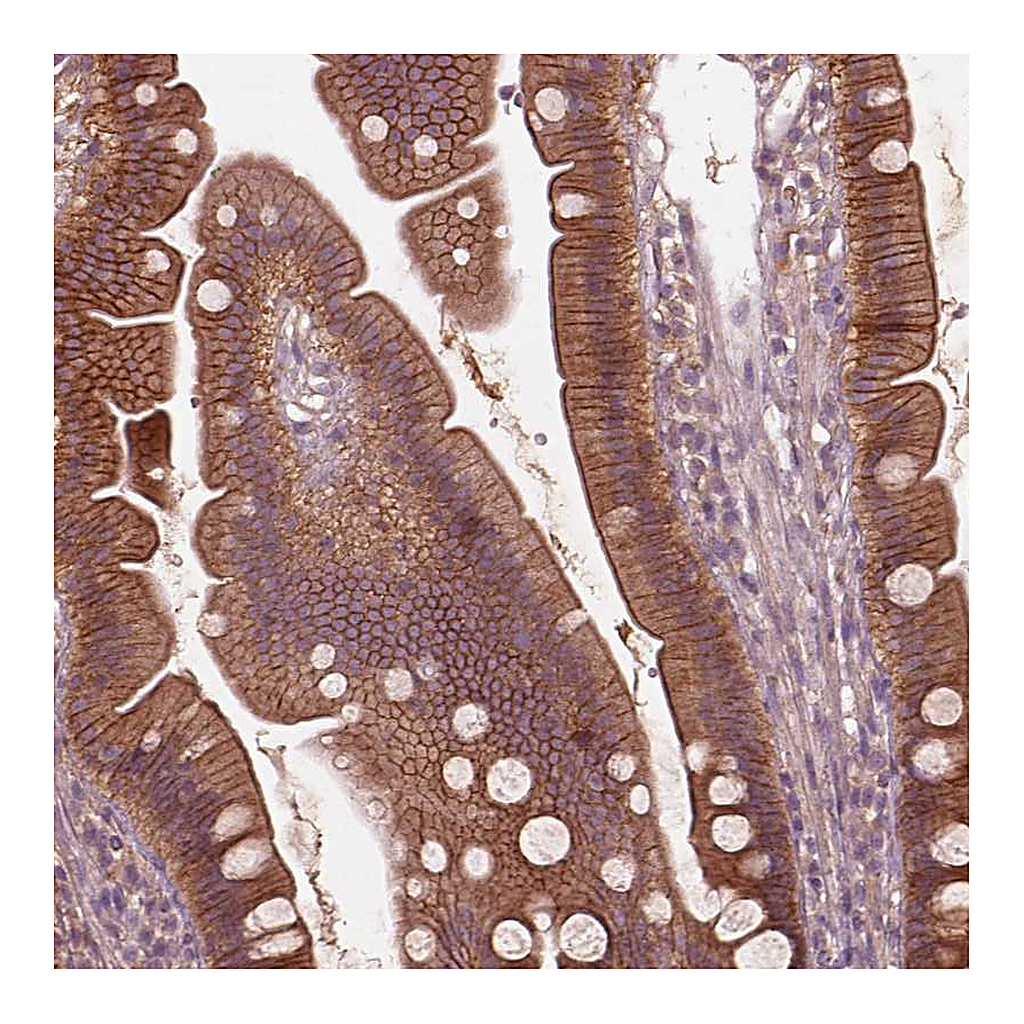 Atlas Antibodies Anti-FAM234A Antibody