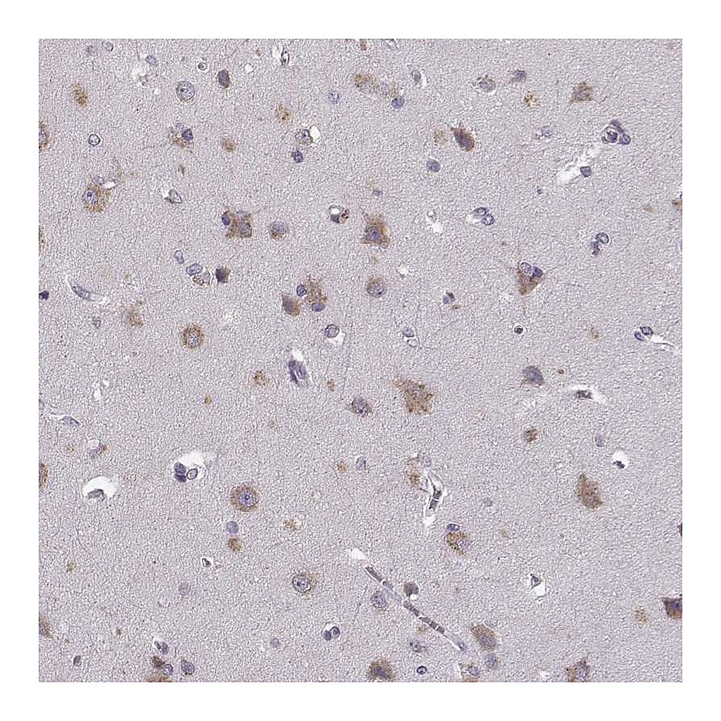 Atlas Antibodies Anti-FAM234B Antibody