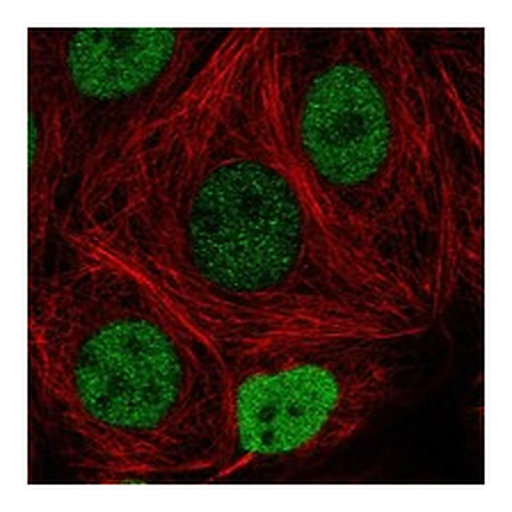 Atlas Antibodies Anti-FAM240C Antibody
