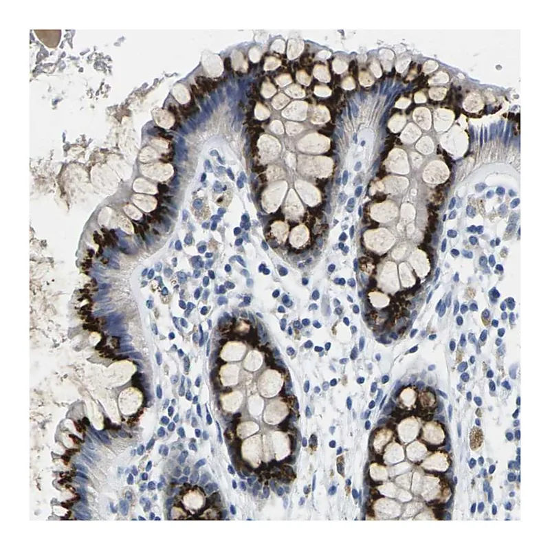 Atlas Antibodies Anti-FAM3D Antibody