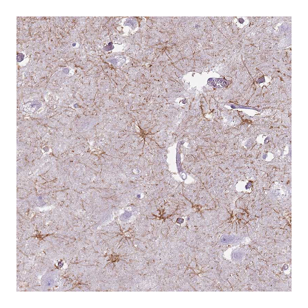 Atlas Antibodies Anti-FAM43B Antibody