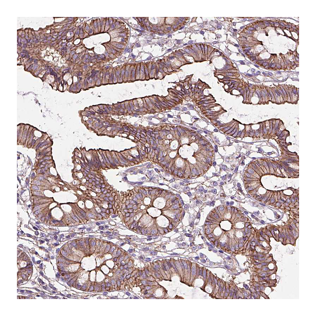 Atlas Antibodies Anti-FAM46A Antibody