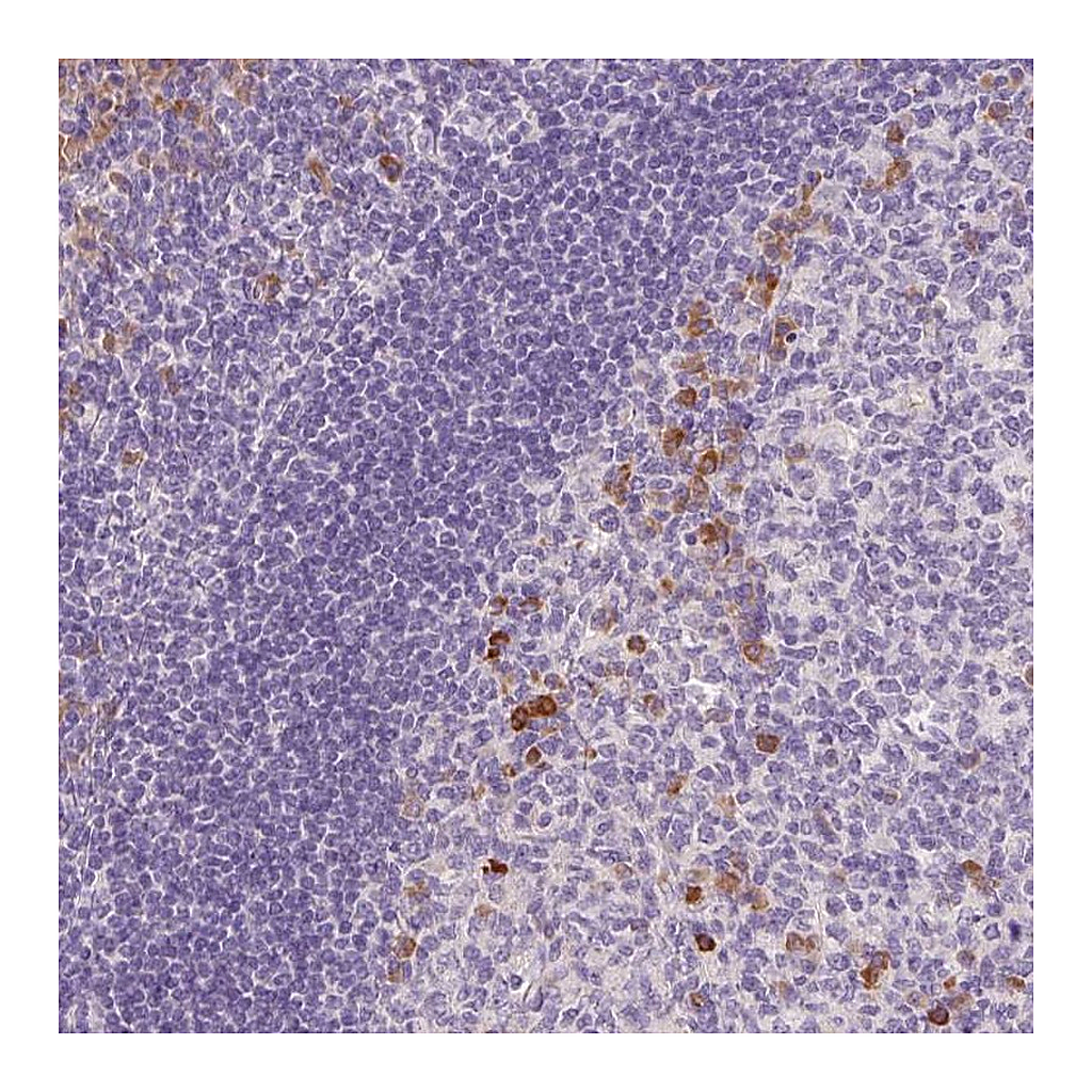 Atlas Antibodies Anti-FAM46C Antibody