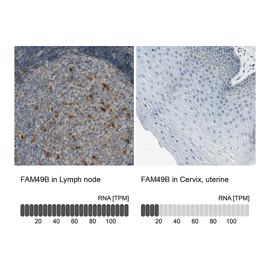 Atlas Antibodies Anti-FAM49B Antibody