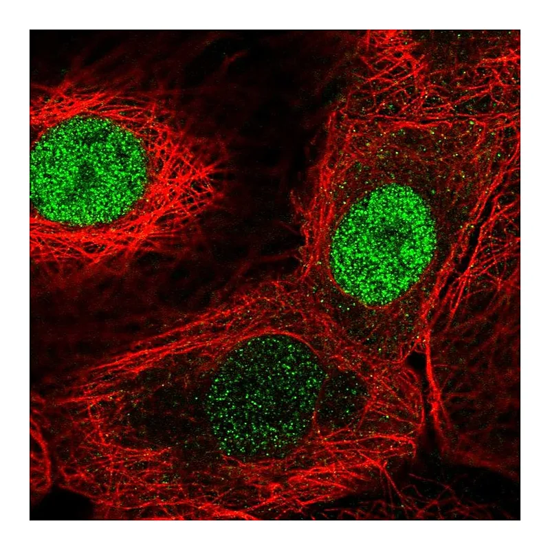 Atlas Antibodies Anti-FAM58A Antibody