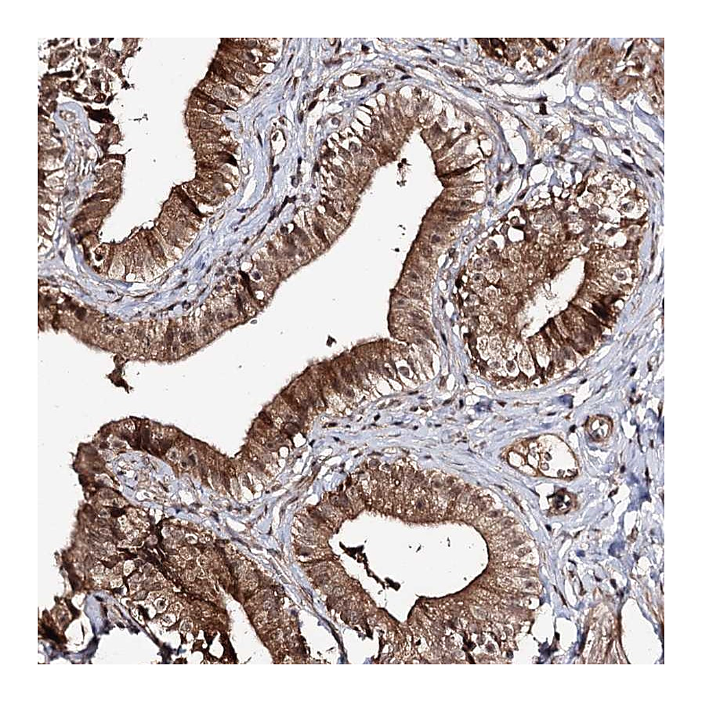 Atlas Antibodies Anti-FAM53B Antibody