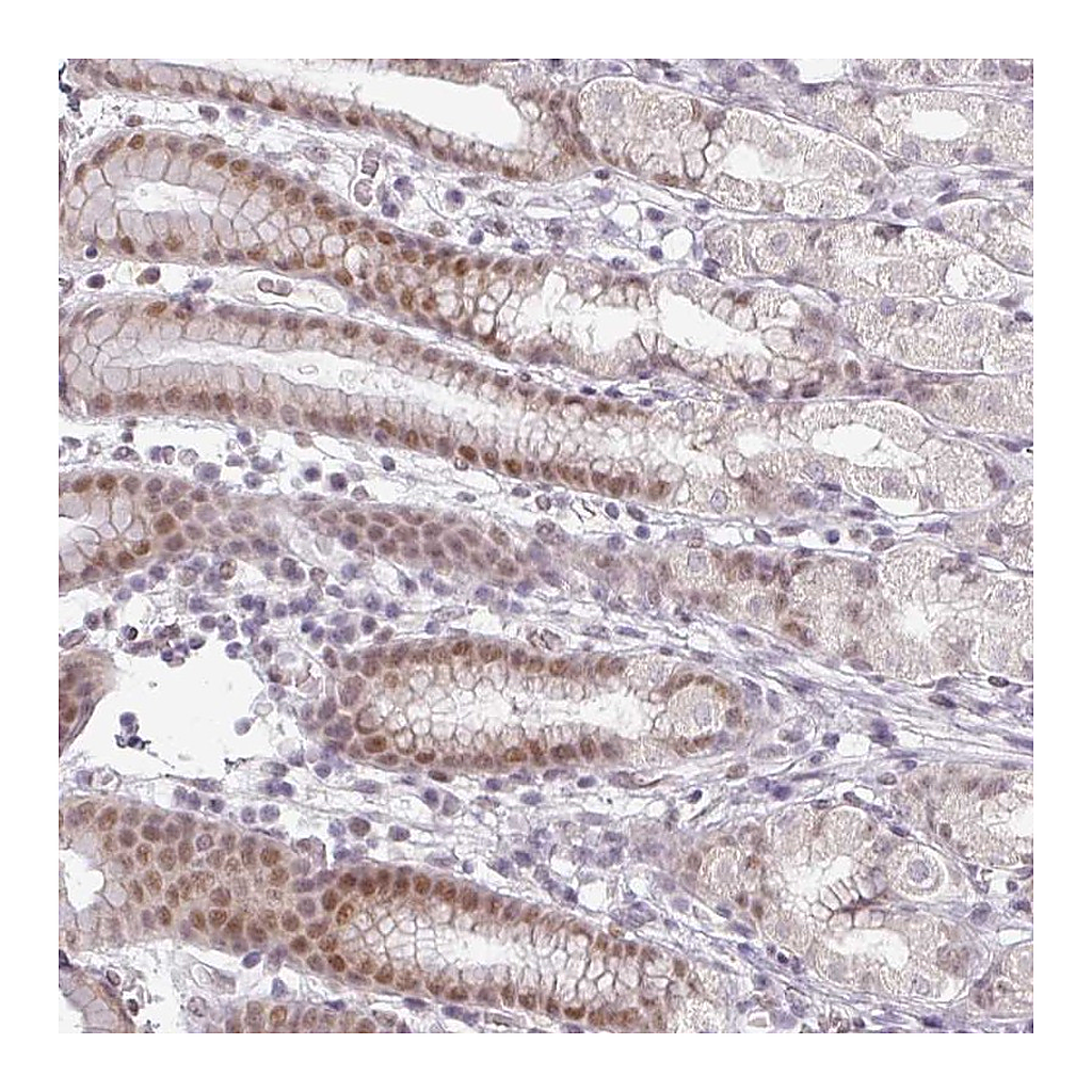 Atlas Antibodies Anti-FAM65C Antibody