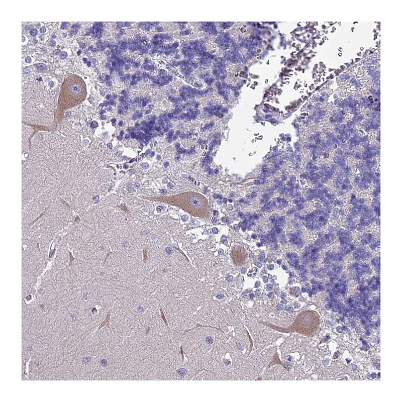 Atlas Antibodies Anti-FAM69B Antibody