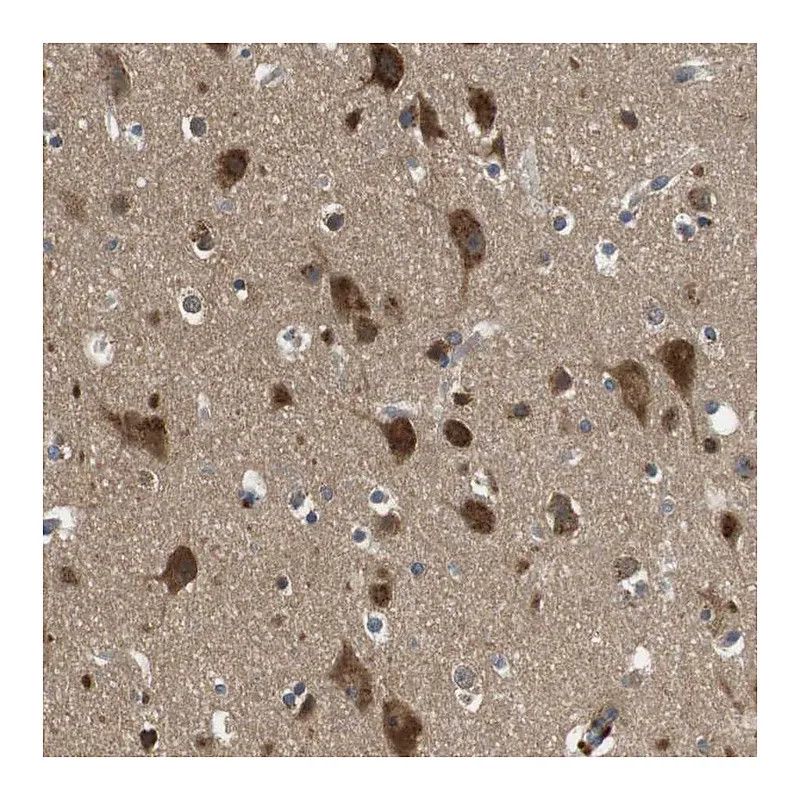 Atlas Antibodies Anti-FAM69A Antibody