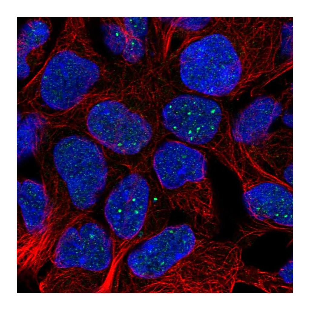 Atlas Antibodies Anti-FAM69B Antibody
