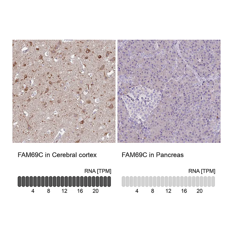Atlas Antibodies Anti-FAM69C Antibody