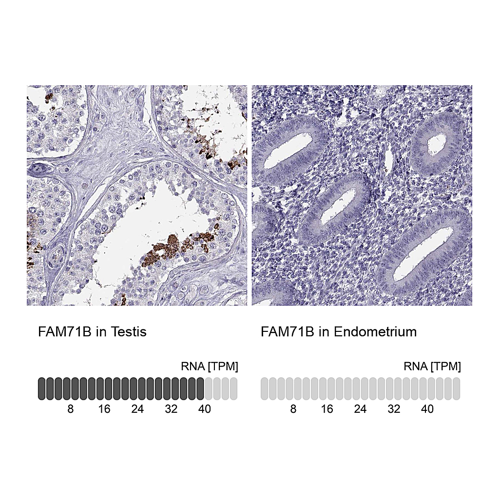 Atlas Antibodies Anti-FAM71B Antibody