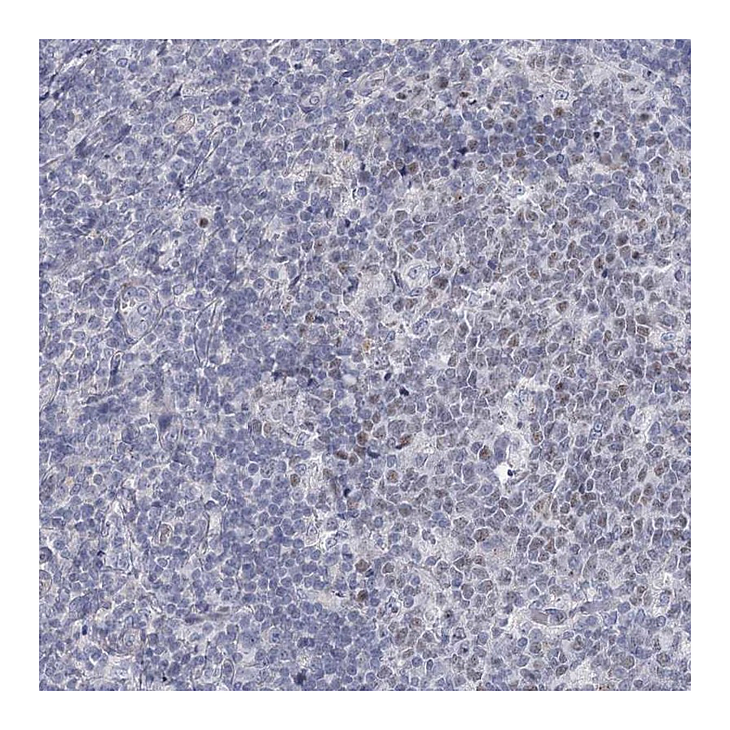 Atlas Antibodies Anti-FAM76B Antibody