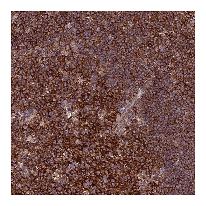 Atlas Antibodies Anti-FAM76A Antibody