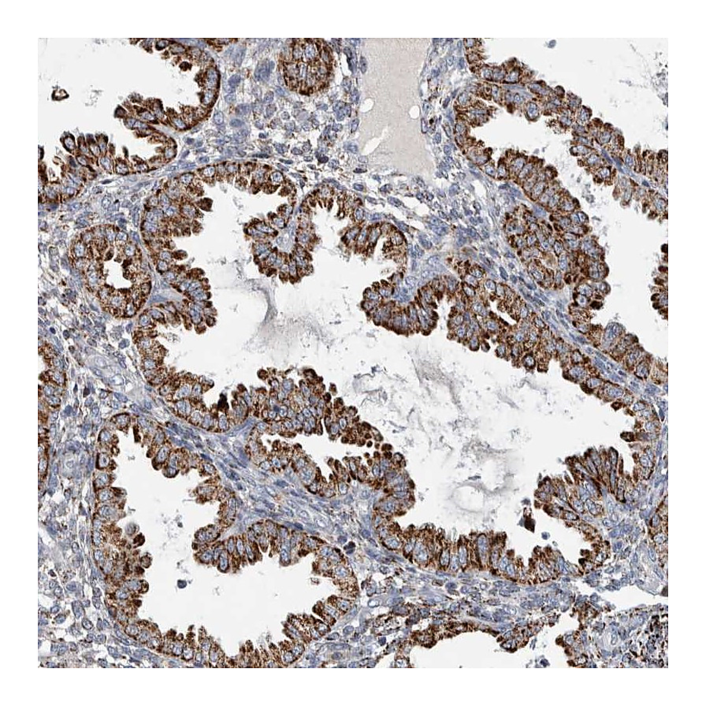 Atlas Antibodies Anti-FAM78A Antibody