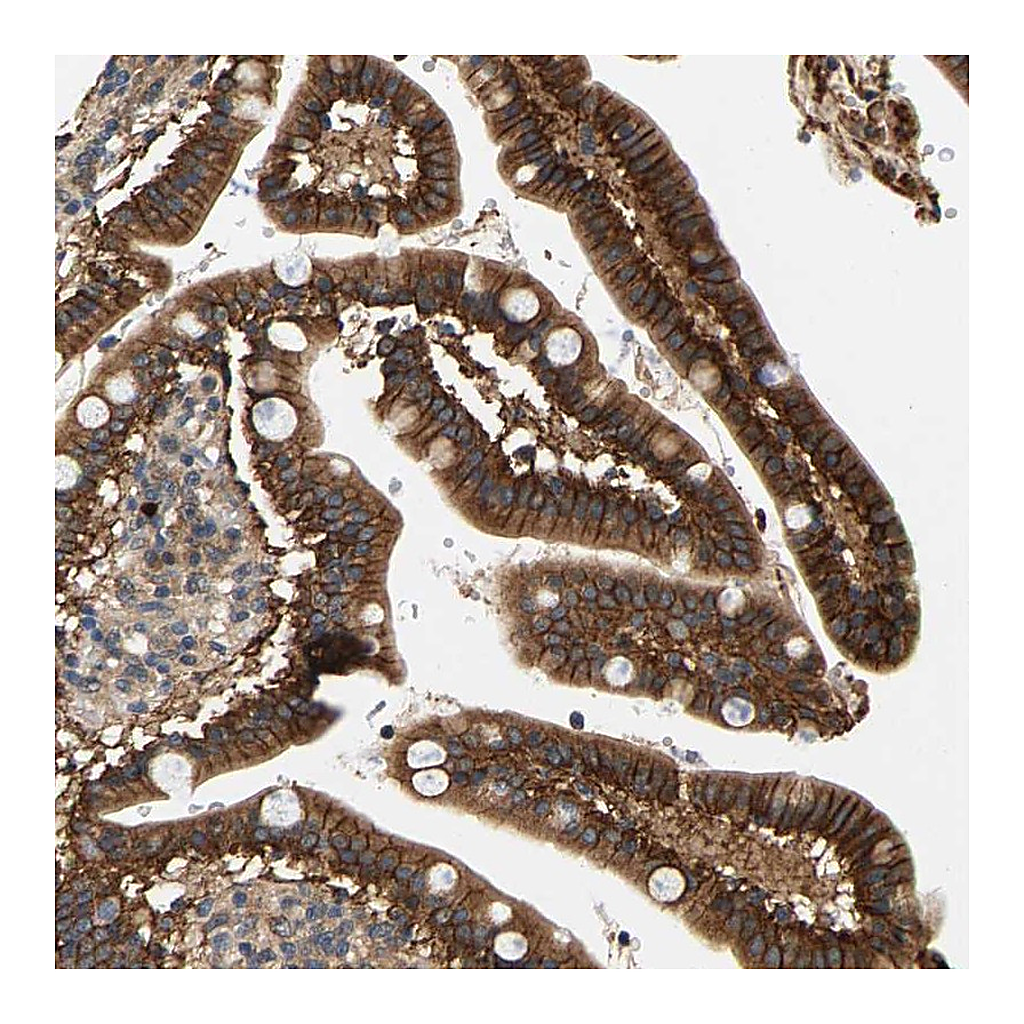 Atlas Antibodies Anti-FAM78A Antibody