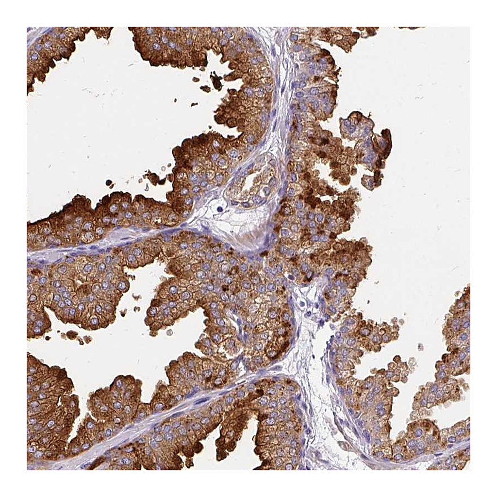 Atlas Antibodies Anti-FAM83C Antibody