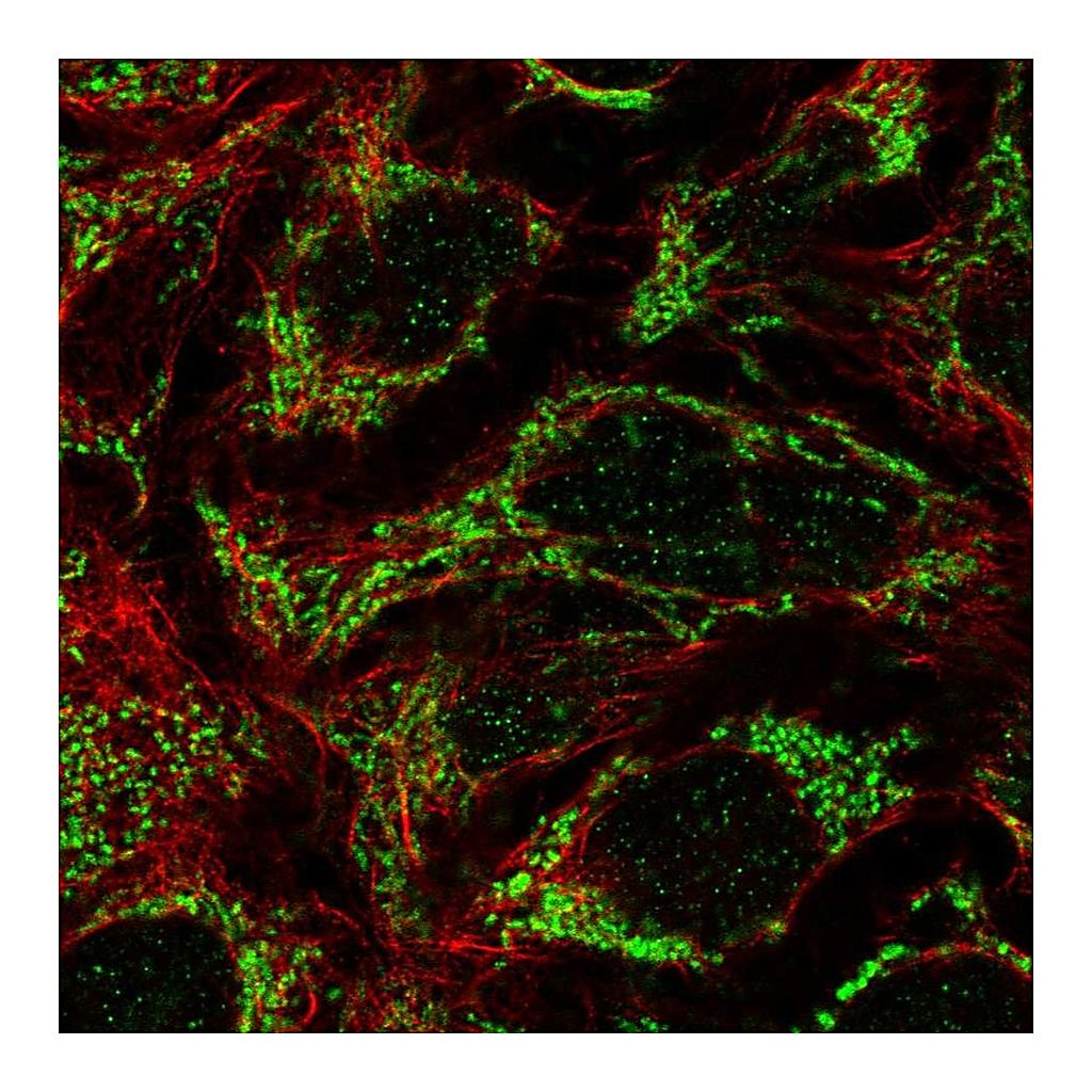 Atlas Antibodies Anti-FAM83F Antibody