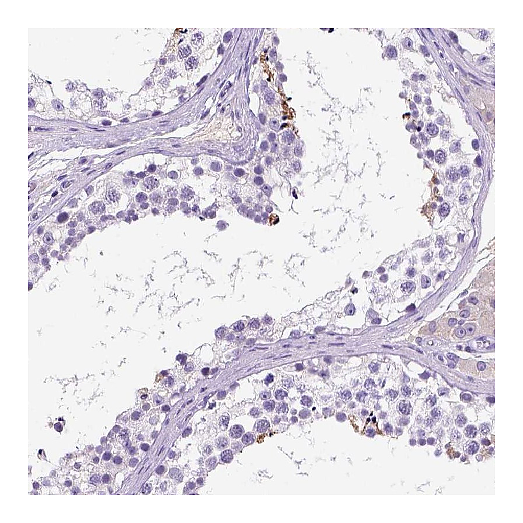 Atlas Antibodies Anti-FAM81B Antibody