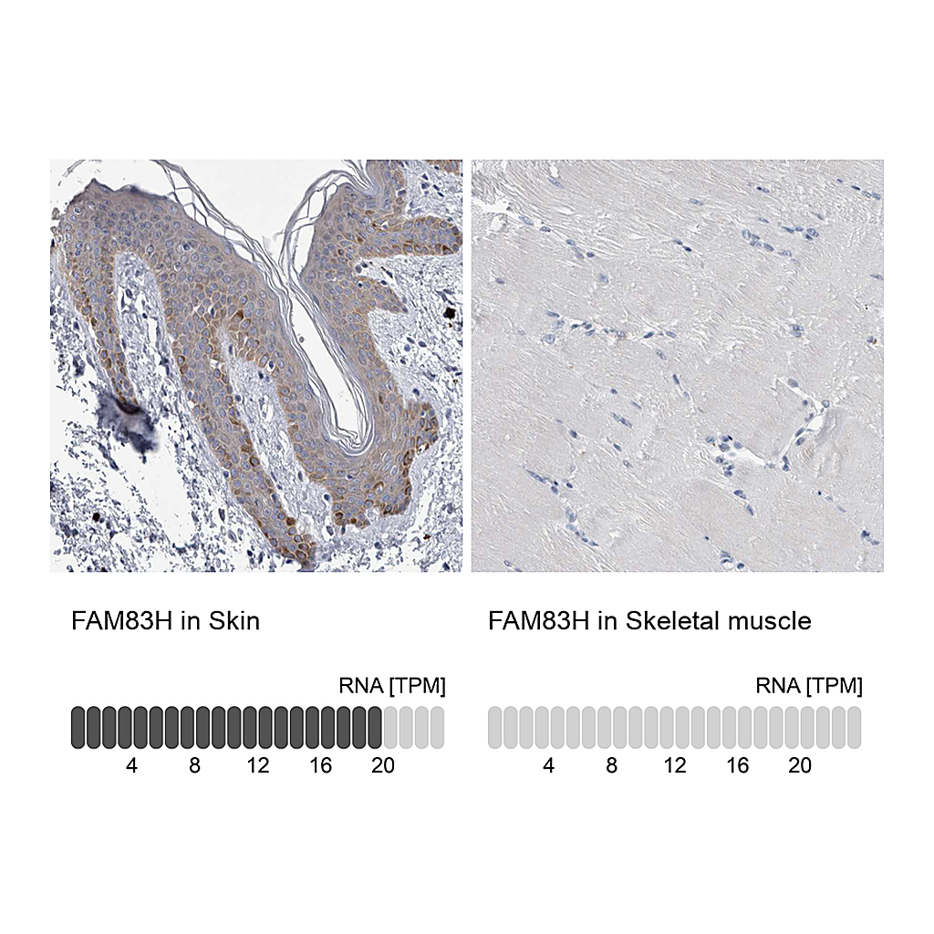 Atlas Antibodies Anti-FAM83H Antibody