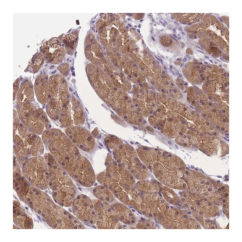Atlas Antibodies Anti-FAM84B Antibody