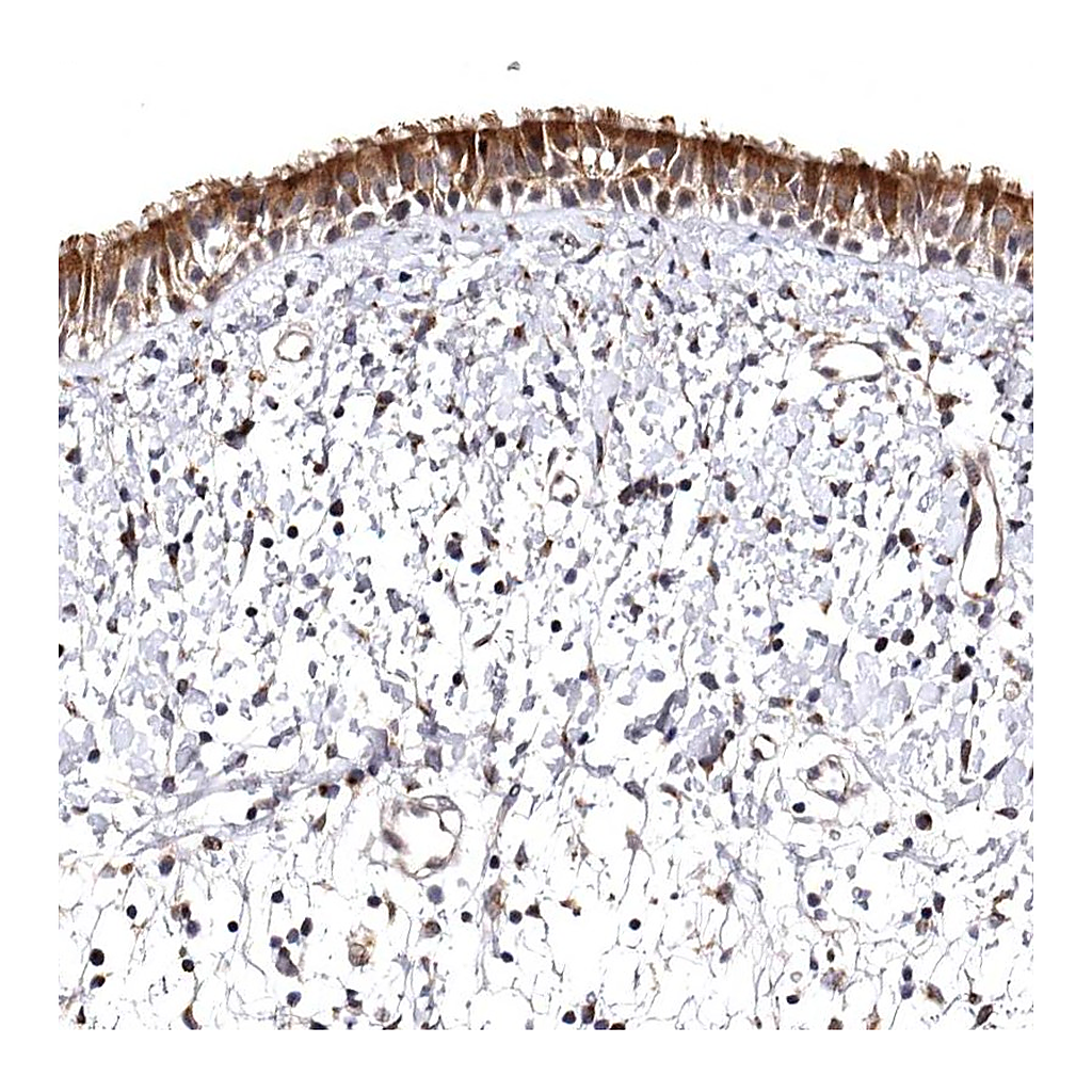 Atlas Antibodies Anti-FAM91A1 Antibody