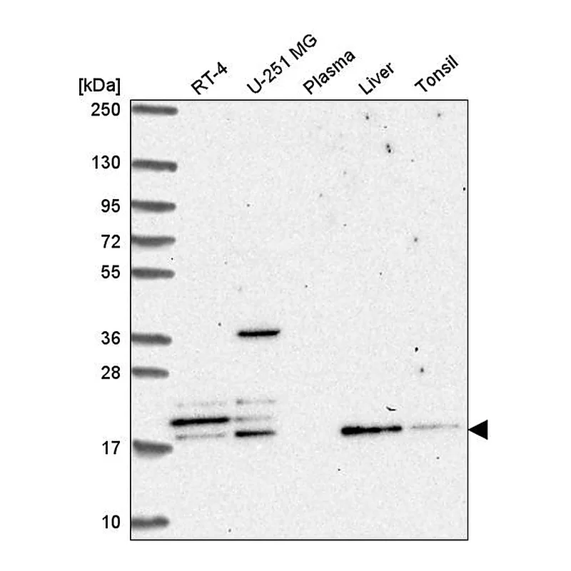 Atlas Antibodies Anti-FAM96A Antibody