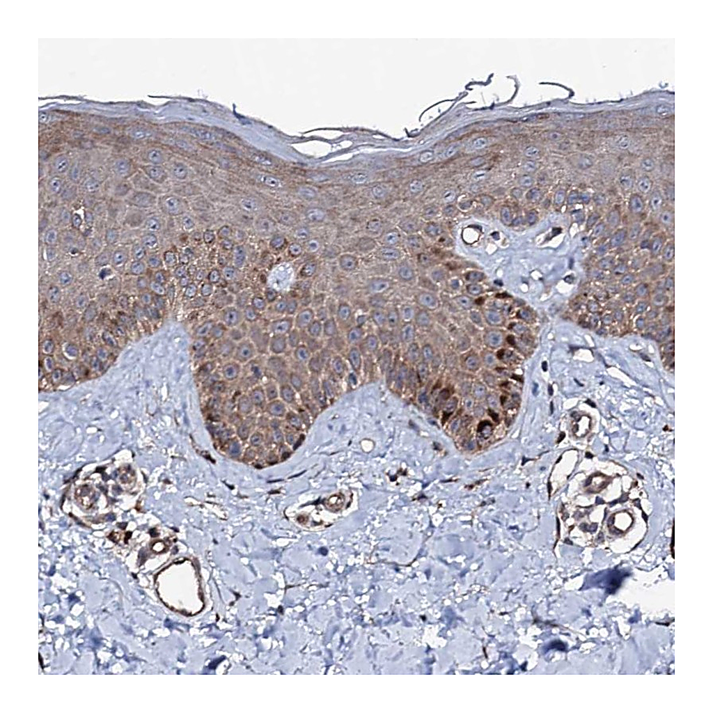 Atlas Antibodies Anti-FAM96A Antibody