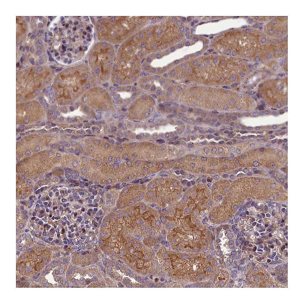 Atlas Antibodies Anti-FAM96B Antibody