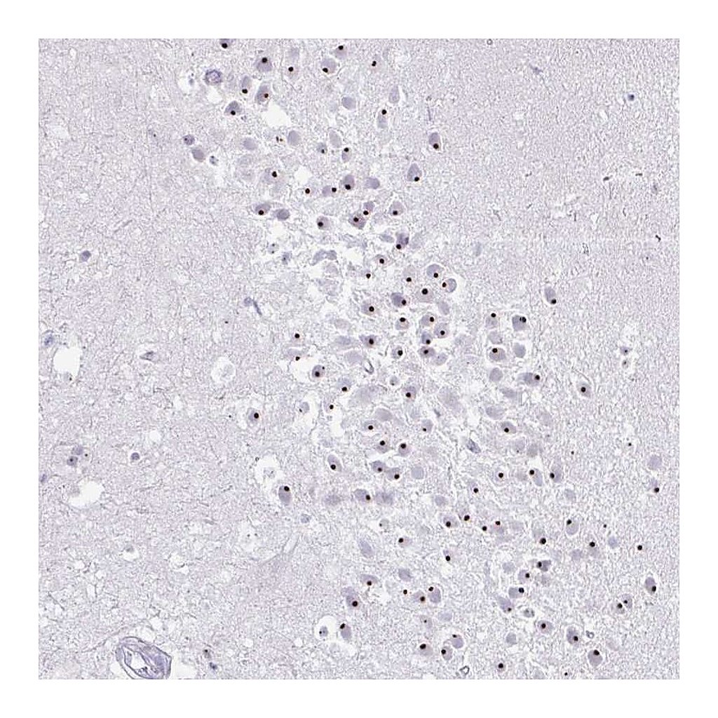 Atlas Antibodies Anti-FAM9A Antibody