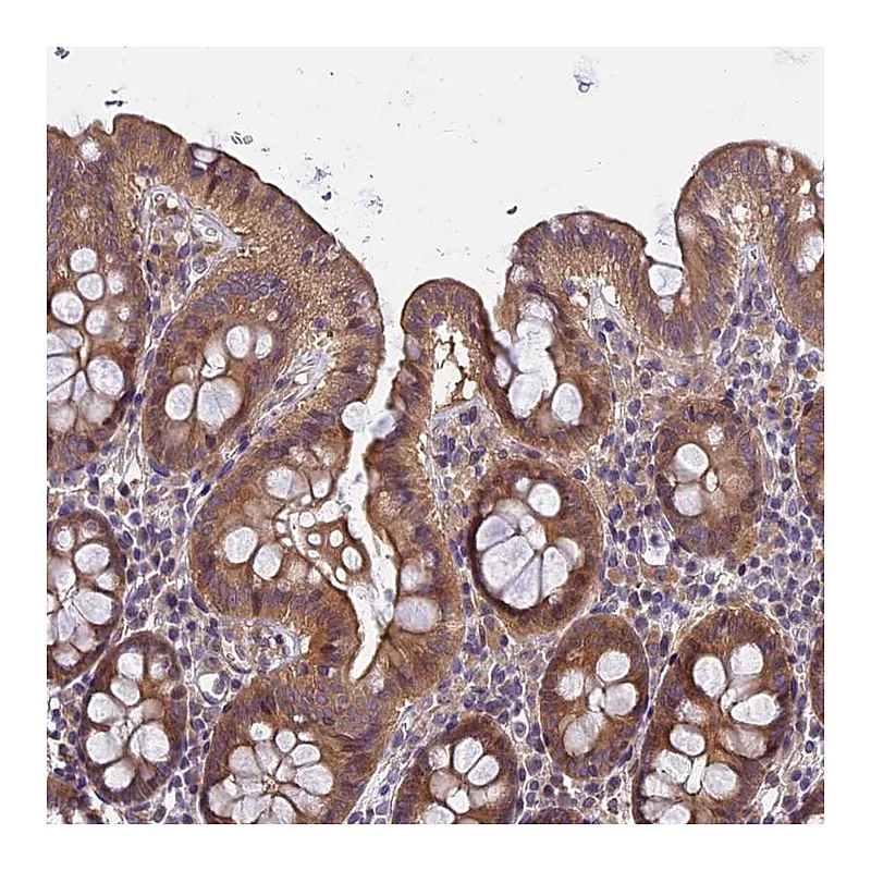 Atlas Antibodies Anti-FAM98C Antibody