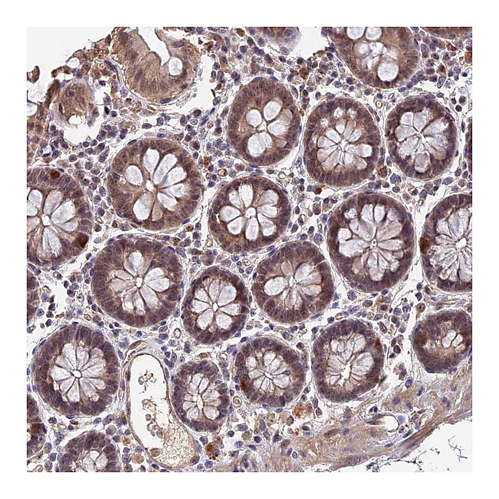 Atlas Antibodies Anti-FAM98C Antibody