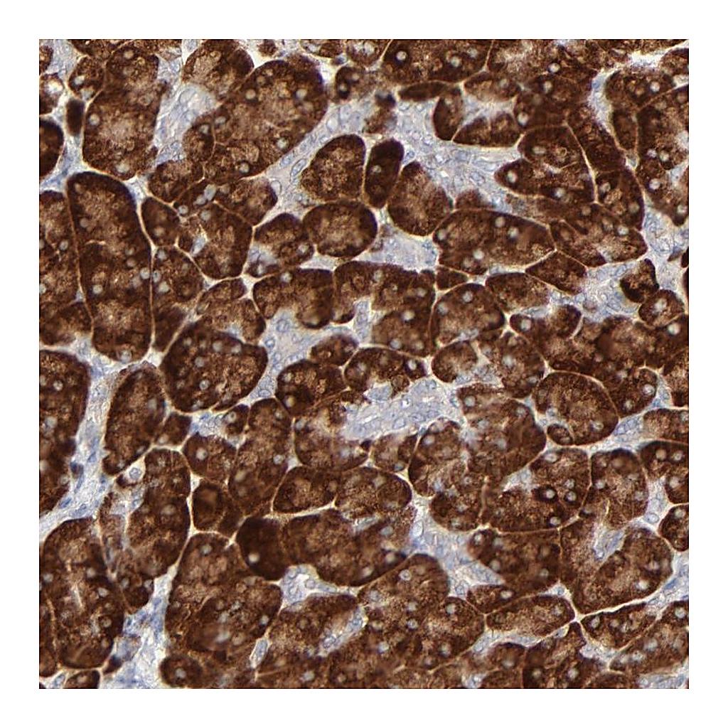 Atlas Antibodies Anti-FANCB Antibody