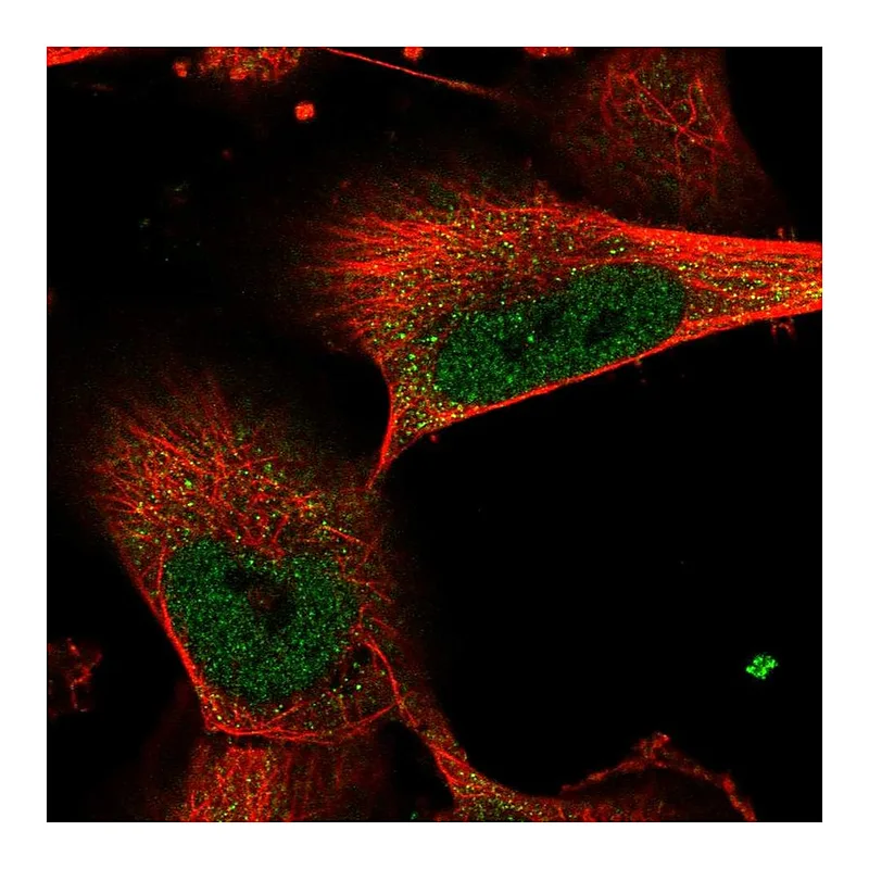 Atlas Antibodies Anti-FANCI Antibody