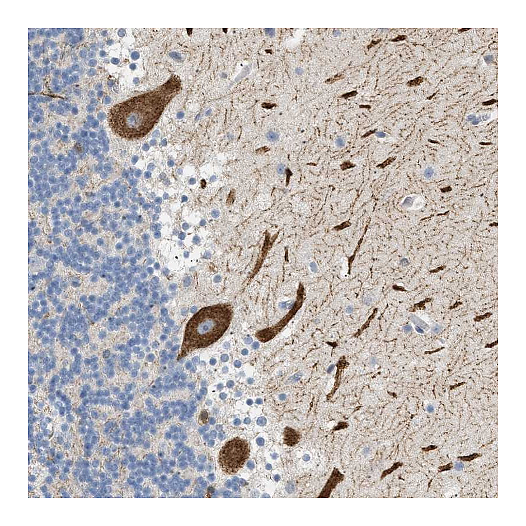Atlas Antibodies Anti-FARS2 Antibody