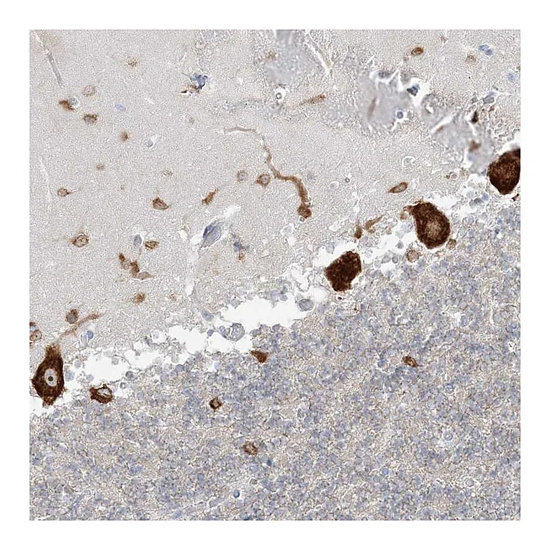 Atlas Antibodies Anti-FARSB Antibody