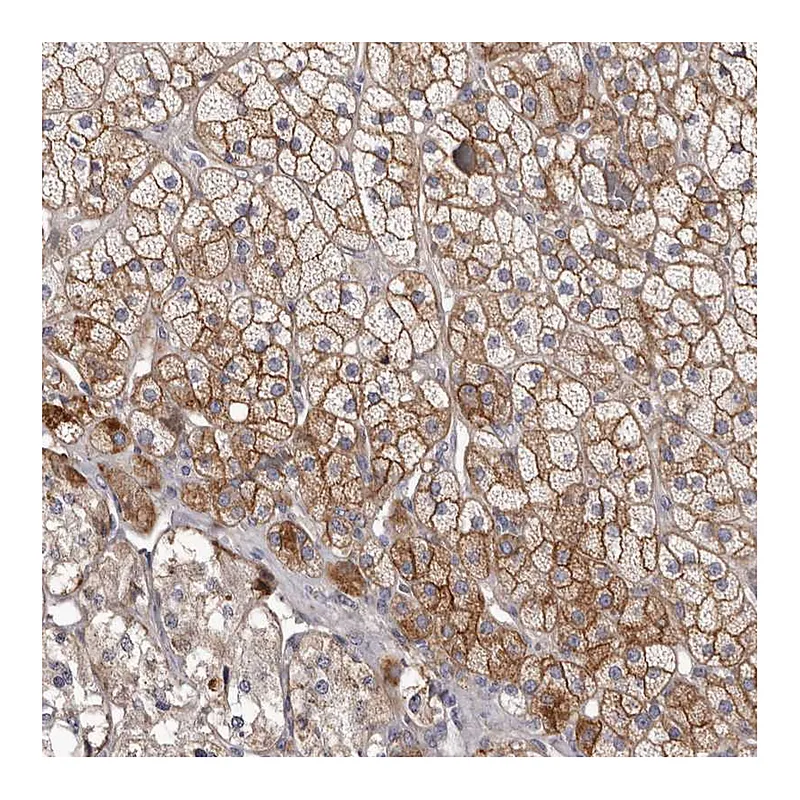 Atlas Antibodies Anti-FAS Antibody